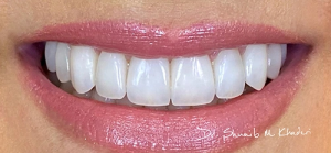 Top Services Offered At A Dental Clinic